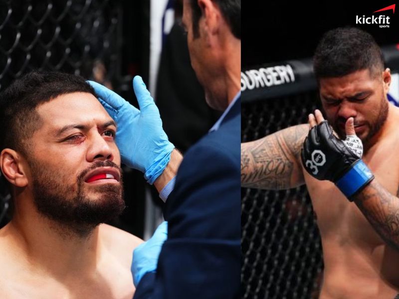 Justin Tafa cảm thấy mắt mình bị "rơi ra" sau pha chọc mắt kinh hoàng tại UFC Jacksonville