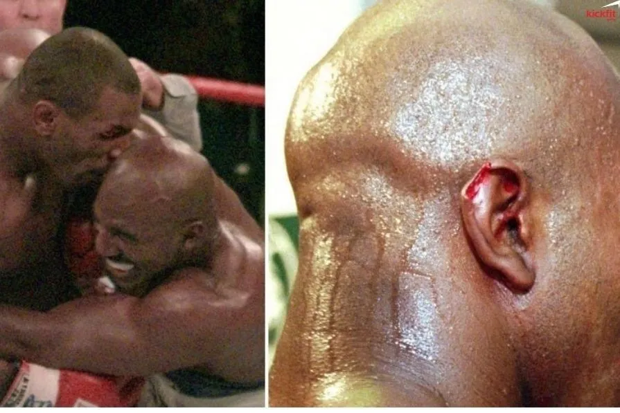 Mike Tyson cắn đứt tai Evander Holyfield, điều gì xảy ra với mảnh tai bị lìa ra?