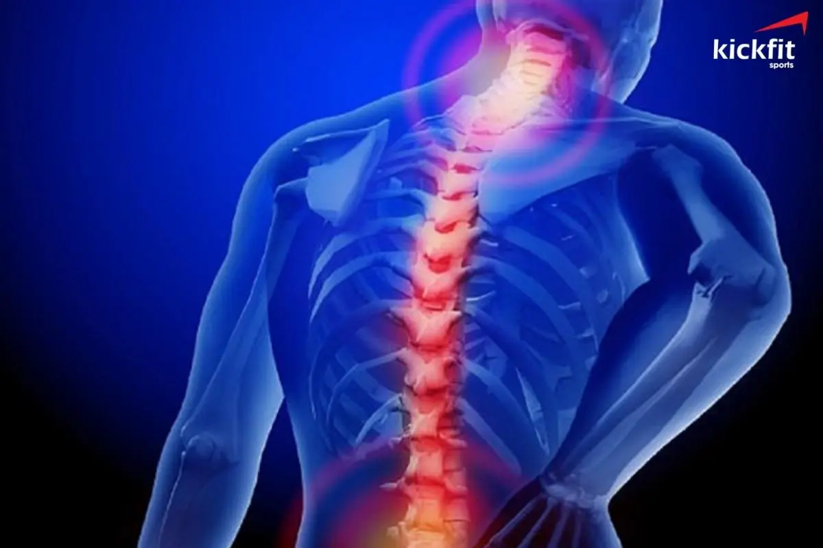 Đau lưng là căn bệnh phổ biến và có nhiều nguyên nhân gây ra