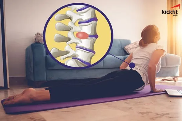 Tập yoga có chữa thoát vị đĩa đệm được không?